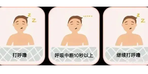 你真的了解睡眠呼吸暫停嗎？6600萬中重度患者正在受害！—仟龍醫(yī)療