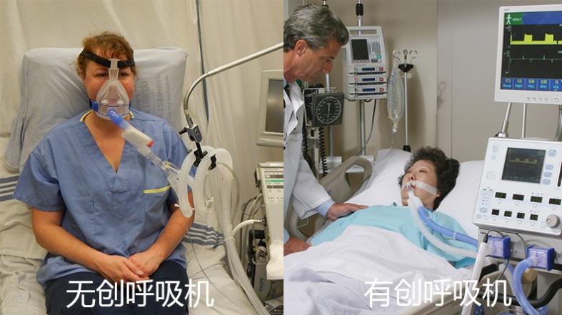 有創(chuàng)呼吸機(jī)和無創(chuàng)呼吸機(jī)